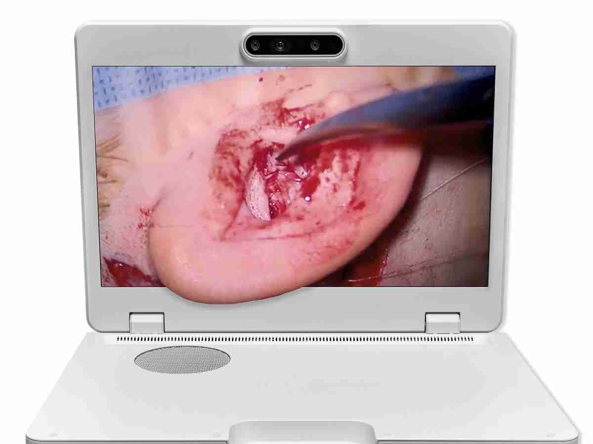 达擎之＂Heads-up 3D显微手术显示系统＂，，整合4K裸眼3D显示及眼球追踪系统，，具备快速追踪人眼移动位置功能，，减轻医师长时间维持固定姿势的负担，，，，让医师能有更宽广清晰的3D立体视野及更舒适的姿势来执行手术。。。